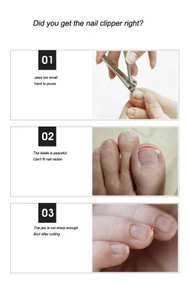 Large Nail Clippers, Toe Nail Clippers-Thick Nail Clippers for Men and Women with Endogenous or Thick Toenails